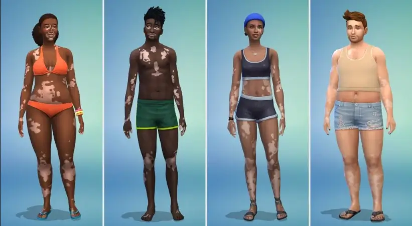 the sims 4 vitiligo imagem 001