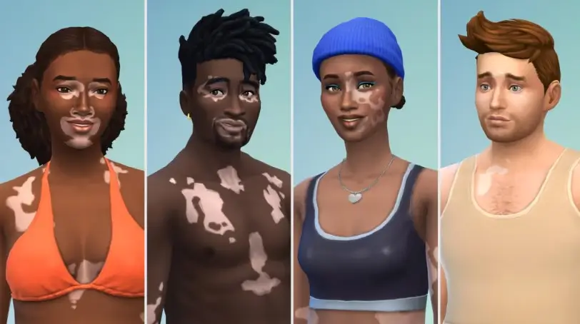 the sims 4 vitiligo imagem 002